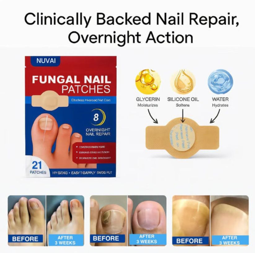Nuvai Fungal Nail Renew Patches Bundle